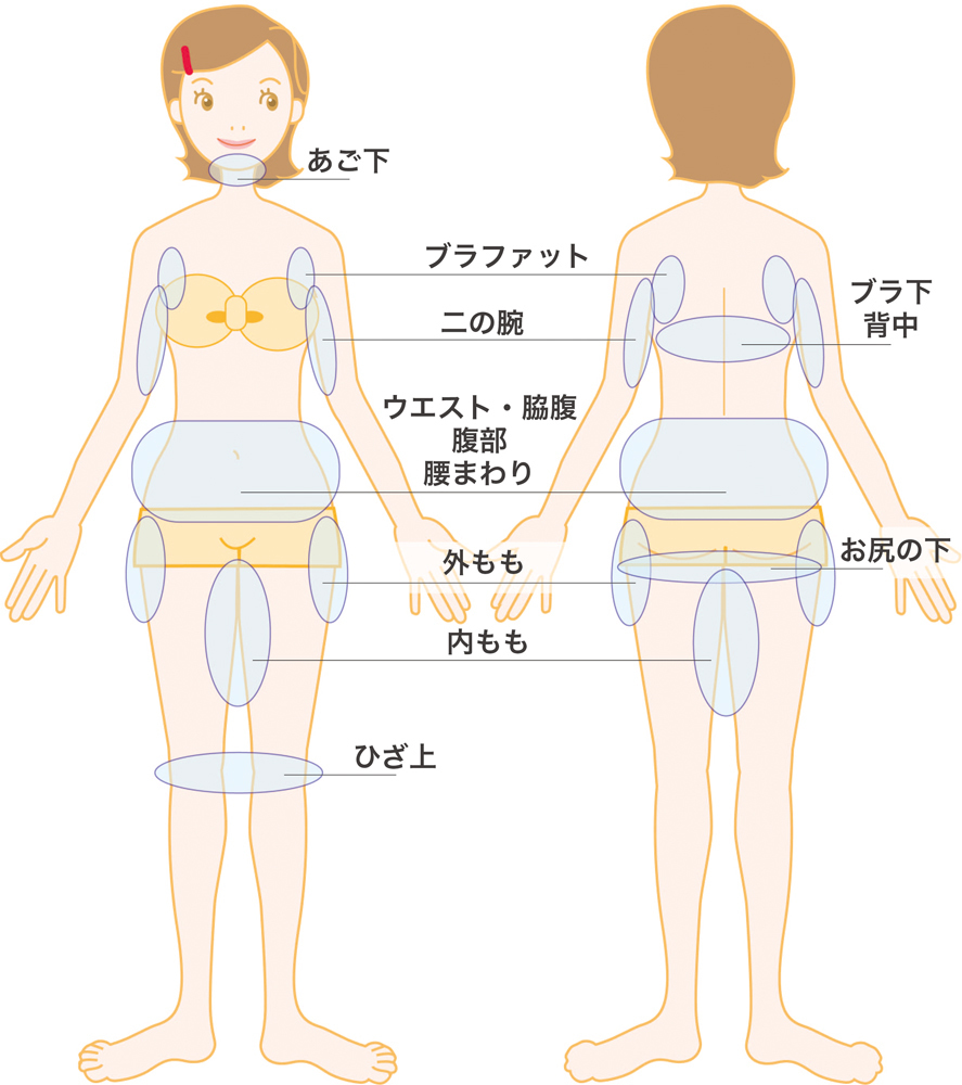 クールスカルプティング・エリート 効果1｜クロスクリニック銀座.jpg