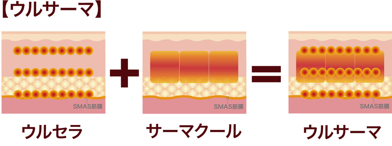 ウルサーマ21／クロスクリニック銀座.jpg