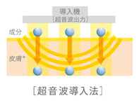 ｓ超音波導入.jpg