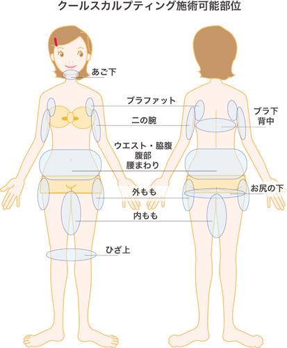 クールスカルプティング｜クロスクリニック銀座1010.jpg