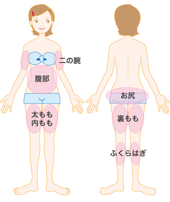 スティムシュアー（エムスカルプト）｜クロスクリニック銀座12.jpg