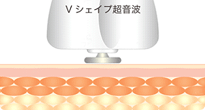 ultra accent8.gif