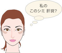 肝斑6レーザートーニング/クロスクリニック銀座.jpg
